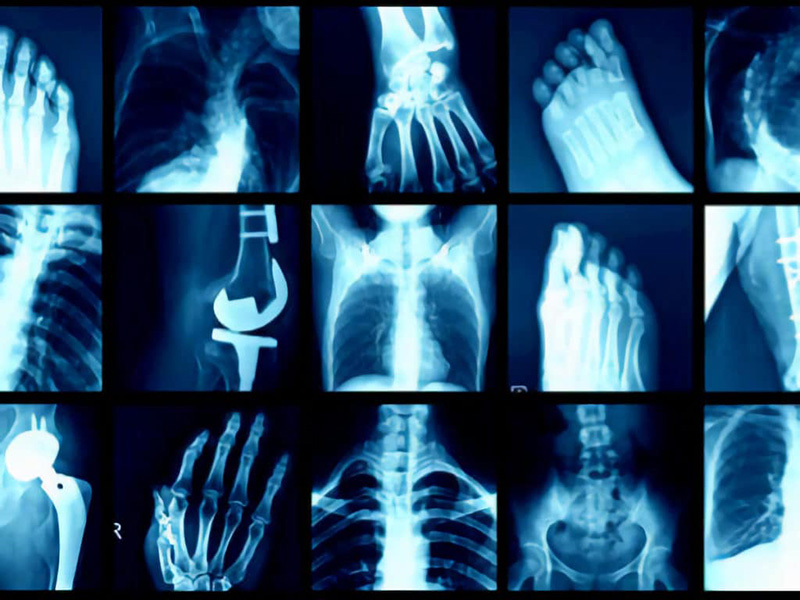 radiografie corpo umano